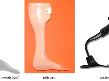 Ankle Foot Orthotic (AFO)
