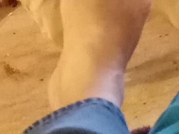 My Right Foot W/O Toes