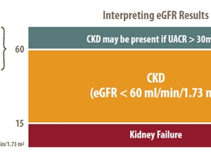 Graphical representation of kidney failure