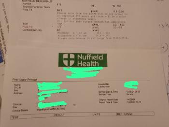 Thyroid, ferritin, D, cortisol results 