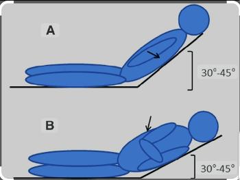 Semi-recumbent position