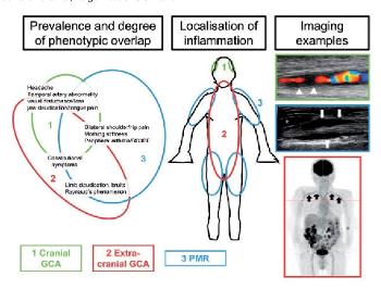 LVV and reducing Pred muscle aches: I am reducing... - PMRGCAuk