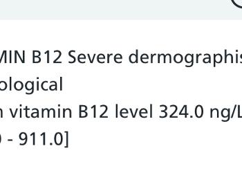 B12 from june