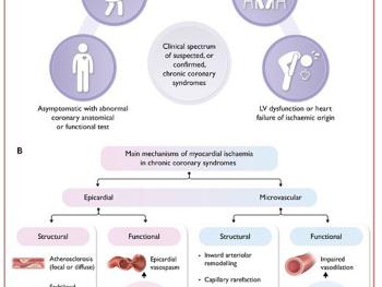 2024 European Society of Cardiology's Management of stable angina guidelines 