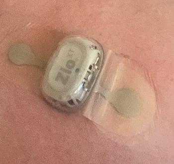 Holter test device