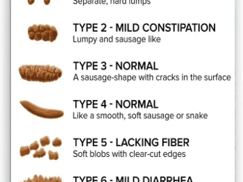 Bristol Stool Chart