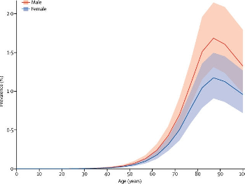 Age Related Increase of PD Picks Up Around Age 45 to 50 Years