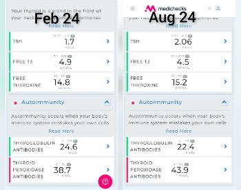 Thyroid results
