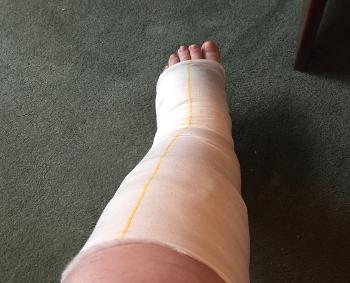 Tubifast yellow line bandage