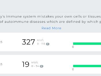 antibodies