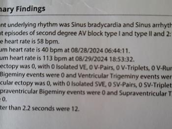 Holter findings 