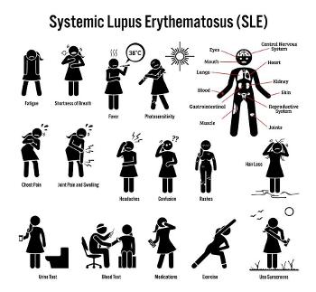 Lupus signs and symtpoms