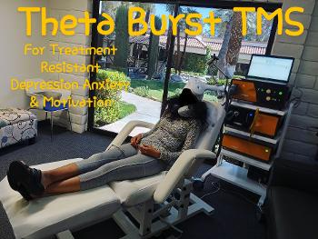 Theta Burst TMS treatment 