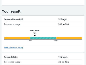 Test result folate and B12