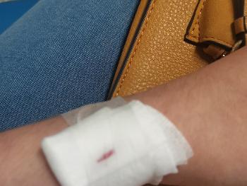 Blood test in wrist. 