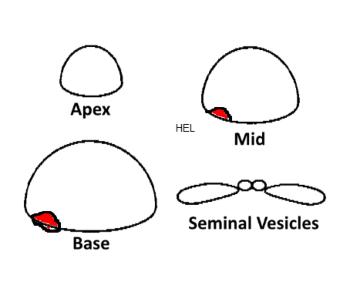 Sketches of Ultrasound Findings