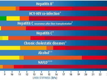 Fibroscan score chart showing bars for progression of fibrosis.