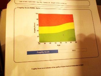 Fragility score from REMS test 