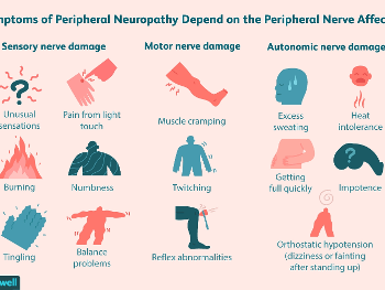 Chart of neuropathy