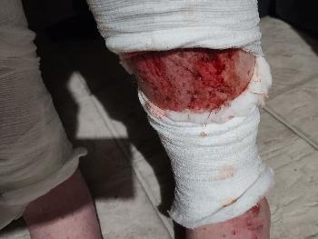 Skin Riping Scared of my skin and what's under it. | MY SKIN