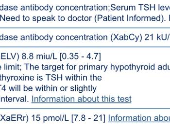 Under active thyroid test results