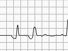 EG strip with pause.