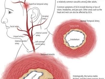 Arteries 3
