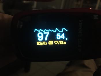 SP02 finger sensor detailing heart rhythm. Not quite symetrical rolling hills.