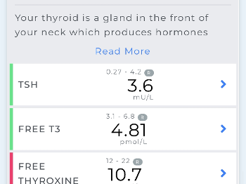 Thyroid test 
