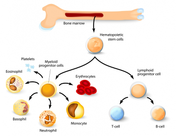 CLL is a lymphoid blood cancer (right of diagram), not a myeloid blood cancer (left)